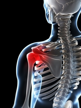 Treatment Options for a Frozen Shoulder